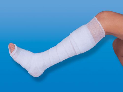 NOBATRICOT, bílý elastický trubkový obvaz, délka 20 m, šířka 1,5 cm