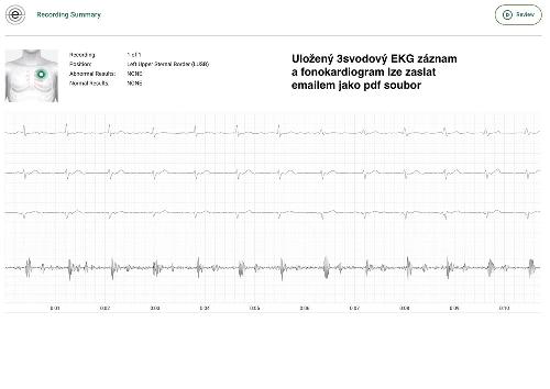 Eko CORE 500 - digitální stetoskop s 3kanálovým EKG pro každodenní praxi, stříbrný