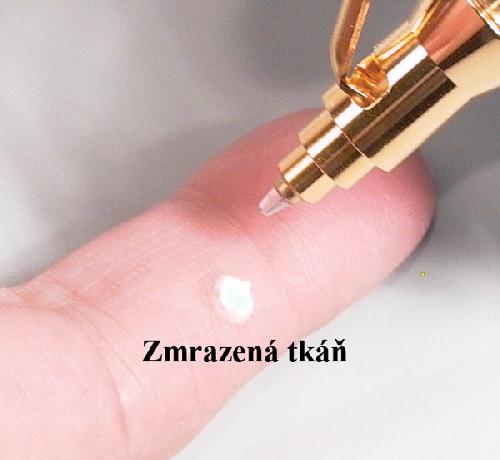 CRYOALFA LUX, univerzální přístroj pro dermatologické aplikace, s tryskou 1 mm