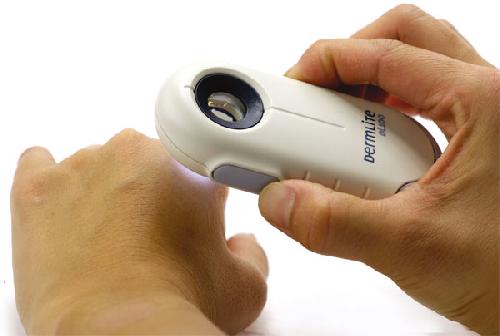 DERMLITE DL-100, moderní dermatoskop, LED diody, trvalá polarizace