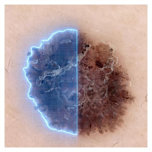 DERMLITE SKEEN - kompletní dermatoskopický systém